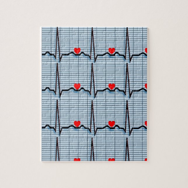 Puzzle EKG Strips (Vertical)