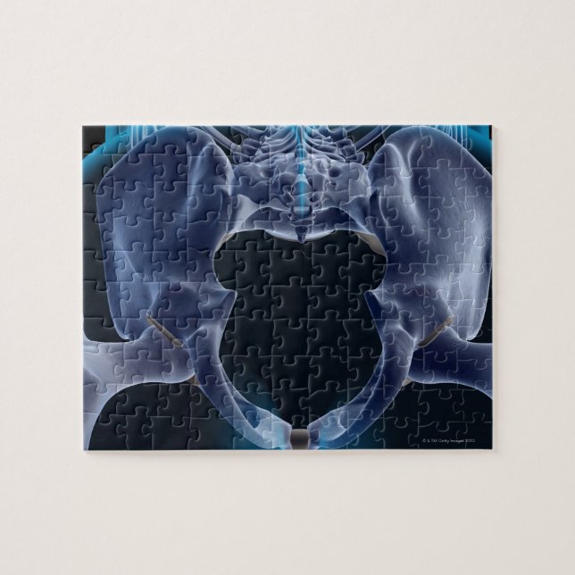 Puzzle Huesos de Pelvis (Horizontal)