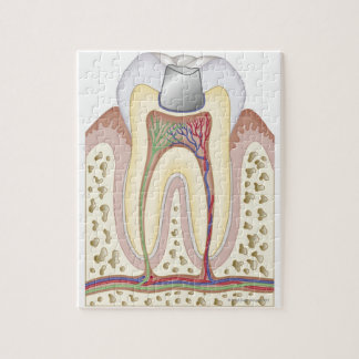 Puzzle Ilustracion del relleno dental