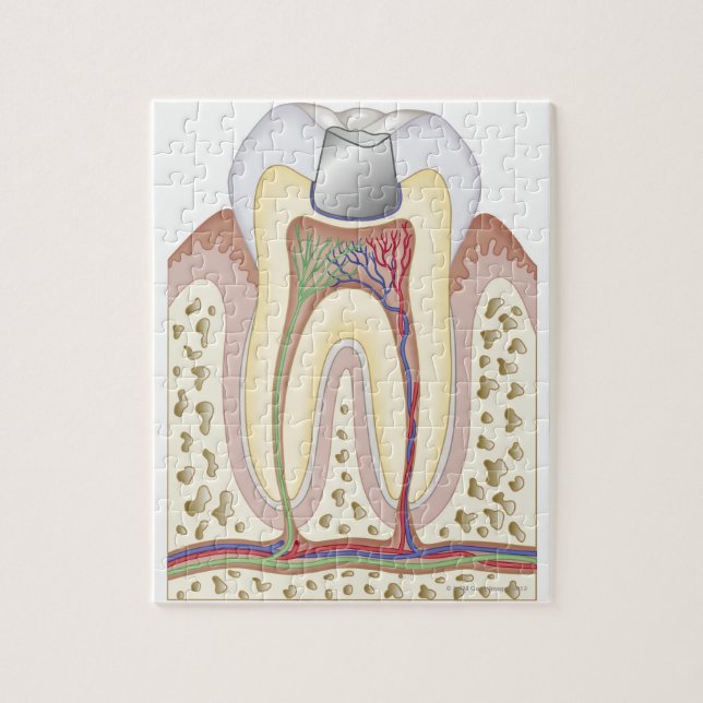 Puzzle Ilustracion del relleno dental (Vertical)