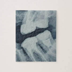 Puzzle Primer de una radiografía dental