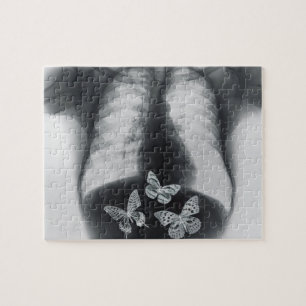 Puzzle Radiografía de mariposas en el estómago