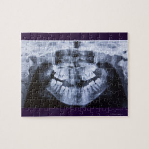 Puzzle Radiografía de un jawline de los chicas tomado co