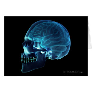 Radiografía del cerebro dentro de un cráneo