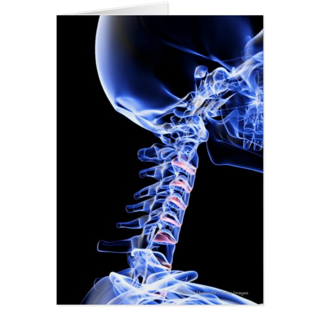 Radiografíe la imagen de los huesos del cuello (Frente)