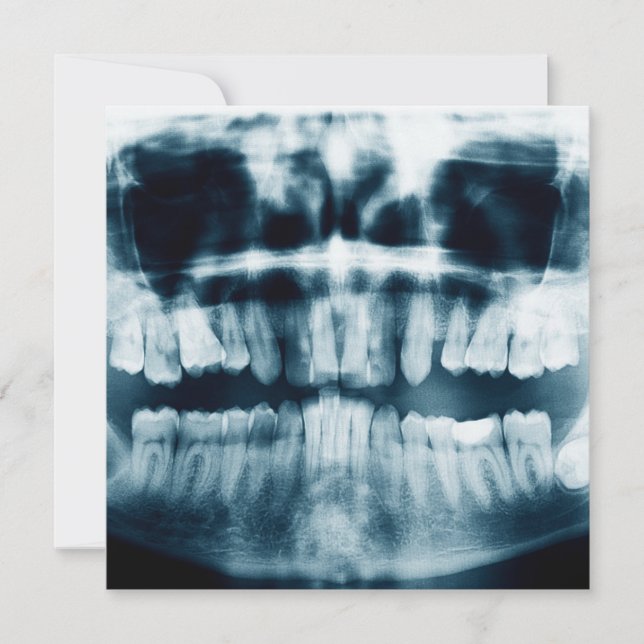 Rayo X de dientes (Anverso)