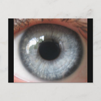 Refelection en una postal del ojo azul