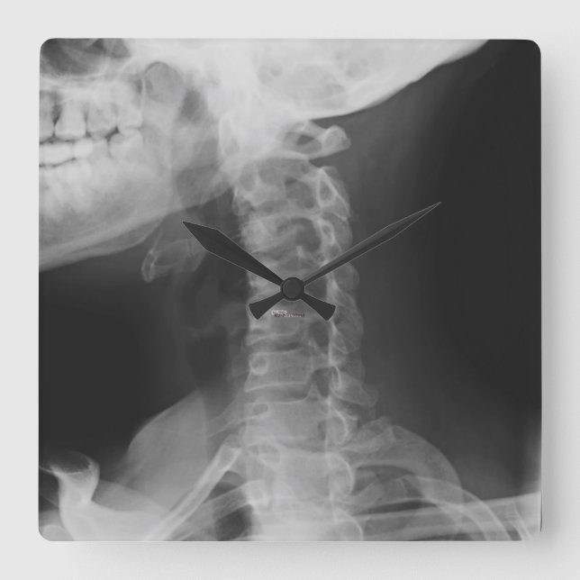Reloj Cuadrado 2 radiografiados (Anverso)