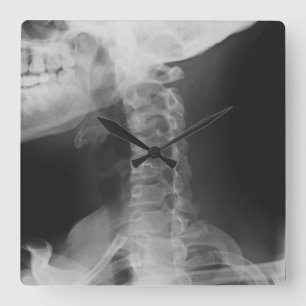 Reloj Cuadrado 2 radiografiados
