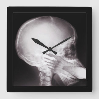 Reloj Cuadrado Pie en rayos X en boca