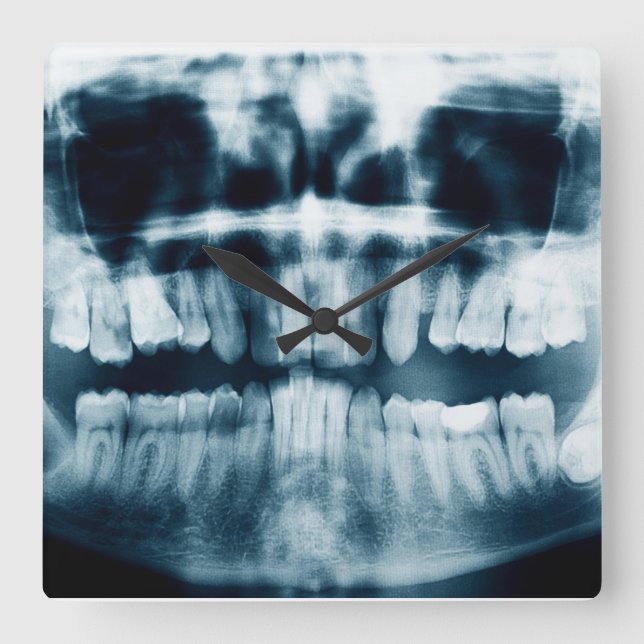 Reloj Cuadrado Radiografía de dientes (Anverso)