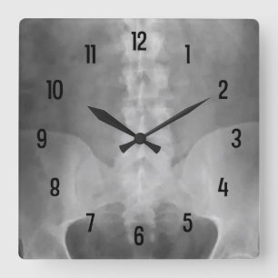 Reloj de pared digital de rayos X