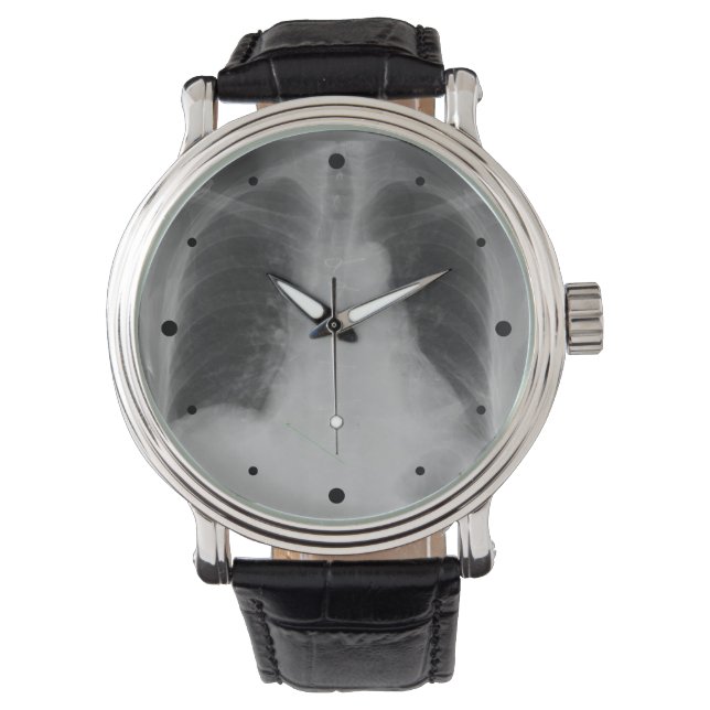 Reloj De Pulsera Chest X Ray ~ watch (Anverso)