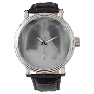Reloj De Pulsera Chest X Ray ~ watch