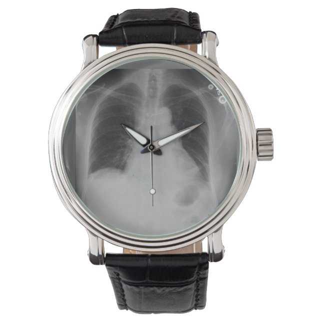 Reloj De Pulsera Chest X Ray ~ watch (Anverso)