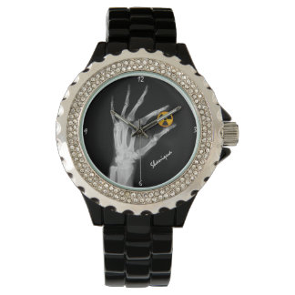 Reloj De Pulsera Mano sosteniendo un símbolo de radiación