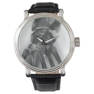 Reloj De Pulsera muñeca normal, rayos X