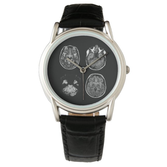 Reloj De Pulsera Resonancia magnética cerebral (Anverso)