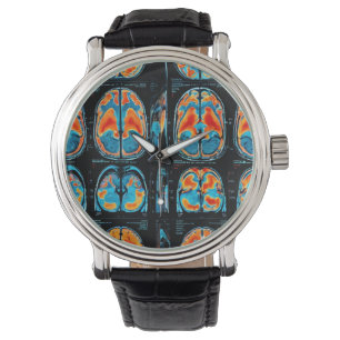 Reloj De Pulsera Revisión cerebral por resonancia magnética