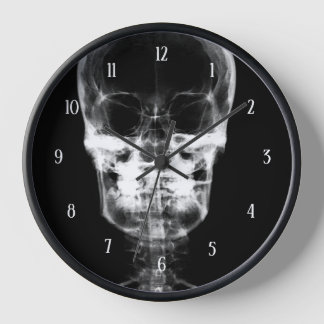 Reloj Rayos X Skull - B&W