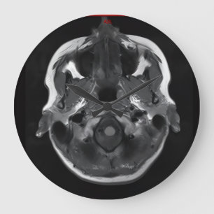 Reloj Redondo Grande im en la cabeza xray mri scan médico