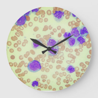 Reloj Redondo Grande Laboratorio de Hematología del Microscopio de Diap