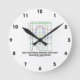 Reloj Redondo Mediano ¿Vea cualquier cosa mal con mi diagrama de