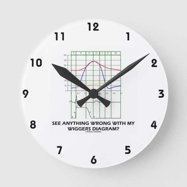 Reloj Redondo Mediano ¿Ves Algo Equivocado Con Mi Diagrama De Wiggers? (Anverso)