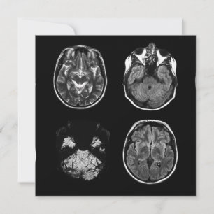 Resonancia magnética cerebral