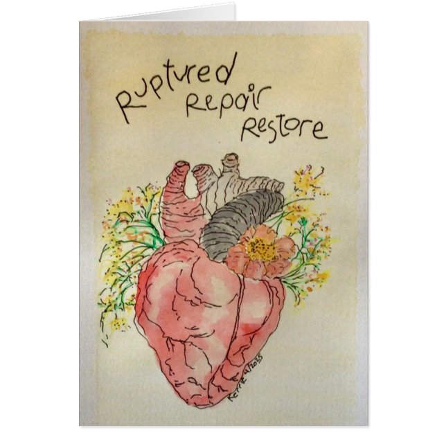 Restauración de la reparación de reproducción en r (Frente)