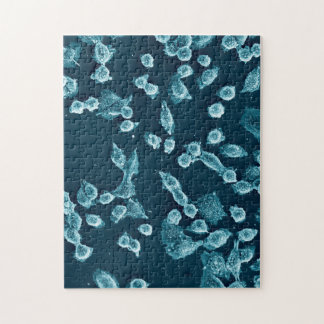 Rompecabezas mitotic Blebby de la célula