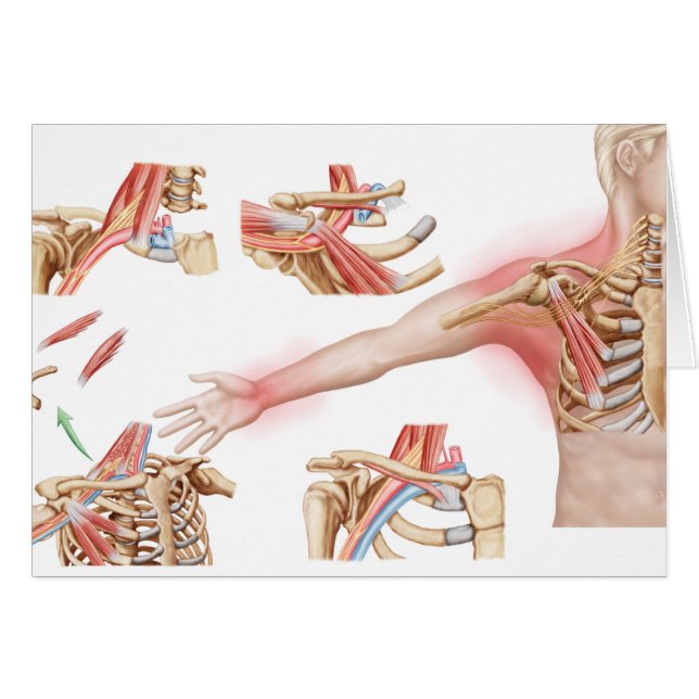 Salida de Thoracic de detección de Ilustracion méd (Anverso (Horizontal))