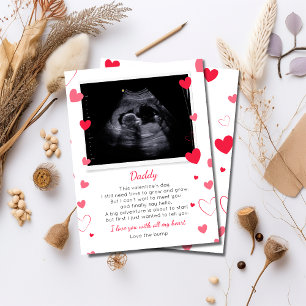San Valentín a papá de Bump