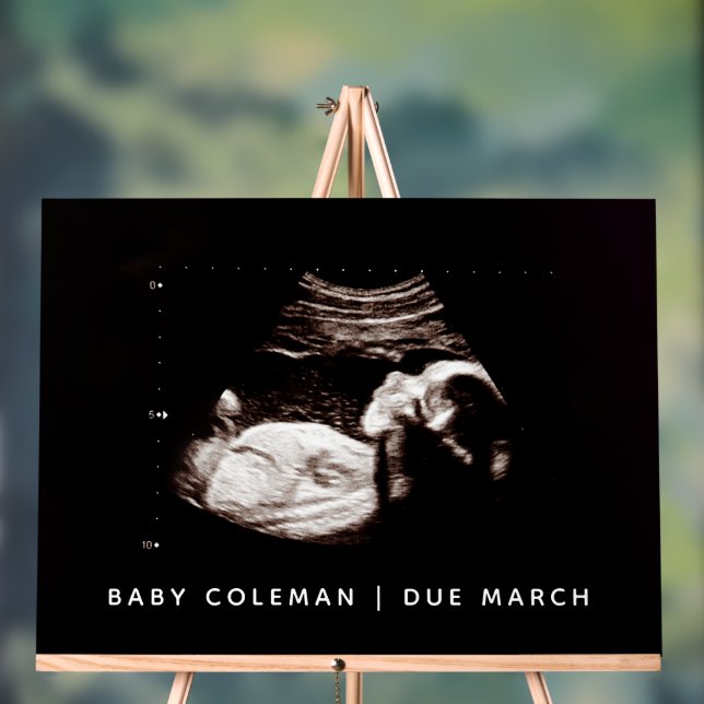 Señal Acrílica Sonograma Baby Shower de Invitación de embarazo (Neutral )