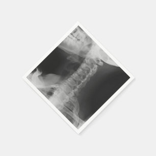 Servilleta De Papel 2 radiografiados (original)