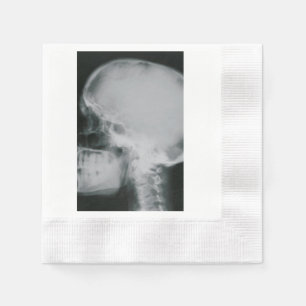 Servilleta De Papel Cráneo de la radiografía