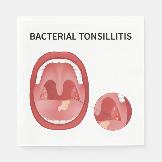 Servilleta De Papel Tonsilitis bacteriana (Anverso)