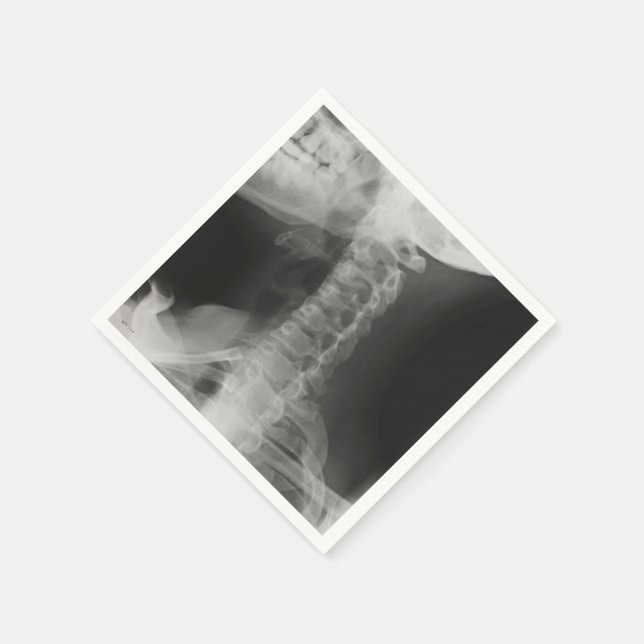 Servilleta De Papel X-Rayed 2 (original) (Borde)