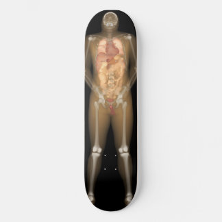 Skateboard Cubierta para hombre de rayos X - Longboard