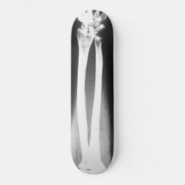 Skateboard El patinaje Breaks de Bradley Boness