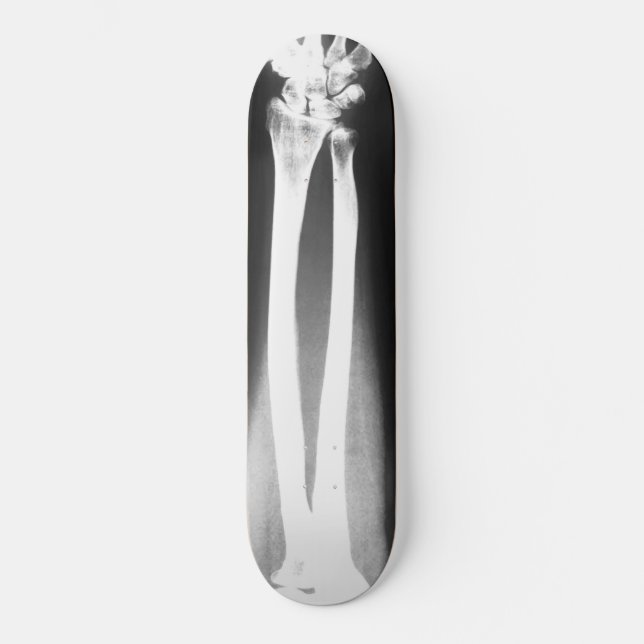 Skateboard El patinaje Breaks de Bradley Boness (Anverso)