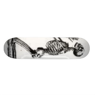 Skateboard esqueleto