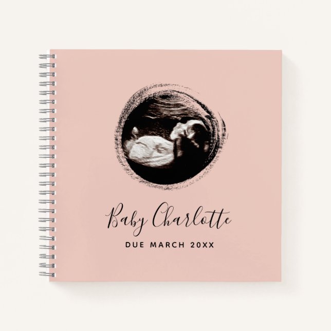 Sonograma Bebé Rosa Libro de Embarazo Ultrasonido (Anverso)