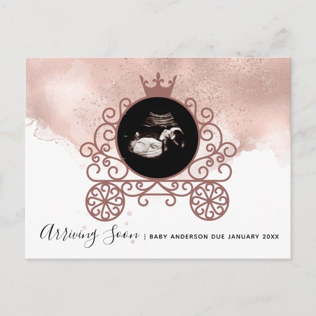 Sonograma de la pequeña princesa Invitación de emb (Anverso)