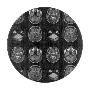 Tabla De Cortar Resonancia magnética cerebral