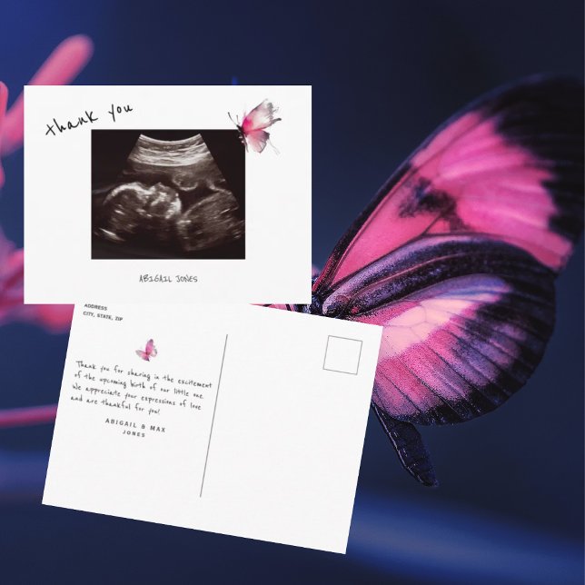  Tarjeta de agradecimiento de ecografía para baby  (Subido por el creador)