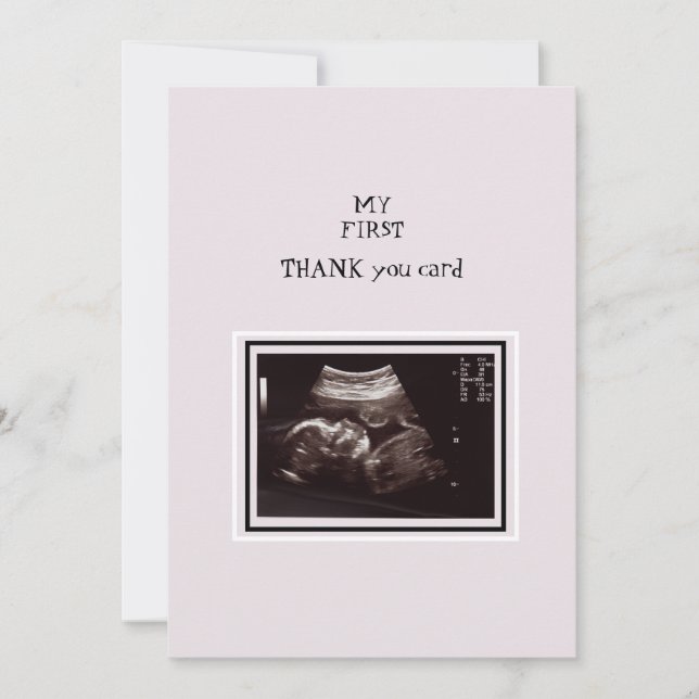Tarjeta De Agradecimiento Foto de ultrasonido Rosa Gracias Bebé (Anverso)