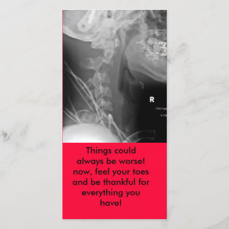 Tarjeta De Agradecimiento ¡la radiografía, cosas podía siempre ser peor!