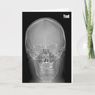 Tarjeta de cumpleaños de Ted de la radiografía