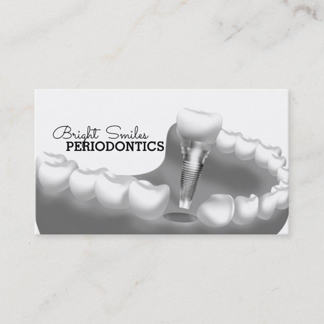 Tarjeta de presentación de Dentista Peridontista (Anverso)